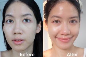 Doctorlogy Sun Gluta Collagen สูตรแพทย์ รีวิว วิตามินผิวขาว วิตามินกันแดด วิตามินลดสิว วิตามินลดรูขุมขน