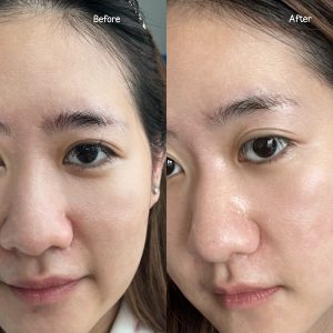 Doctorlogy รีวิว วิตามินผิวขาว วิตามินกันแดด วิตามินลดสิว วิตามินลดรูขุมขน สูตรแพทย์ 1