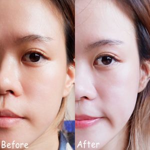 doctorlogy วิตามินสูตรแพทย์ sun gluta collagen วิตามินลดรูขุมขน haya multi collagen วิตามินลดสิว