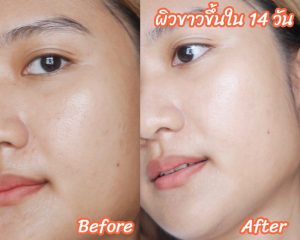 doctorlogy วิตามินสูตรแพทย์ sun gluta collagen วิตามินลดรูขุมขน haya multi collagen วิตามินลดสิว