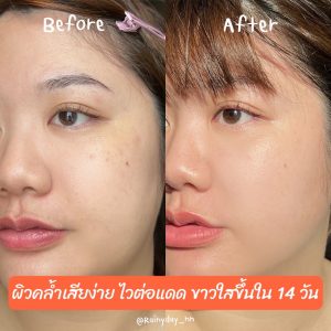 doctorlogy วิตามินสูตรแพทย์ sun gluta collagen วิตามินลดรูขุมขน haya multi collagen วิตามินลดสิว